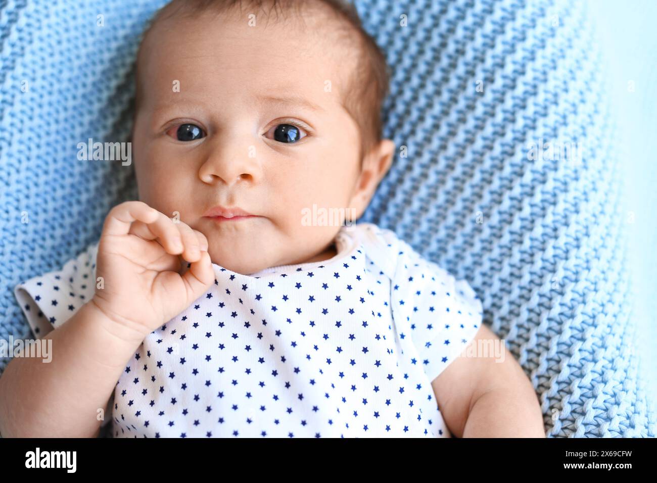 Conjonctivites. Petit bébé avec les yeux rouges au lit, gros plan Banque D'Images