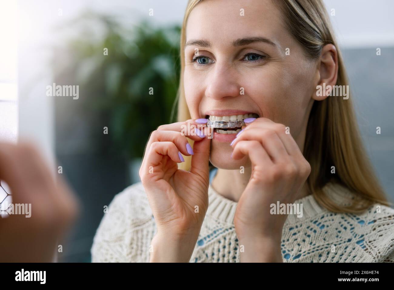 femme insérant des aligneurs dentaires transparents invisibles pour redresser les dents tordues Banque D'Images