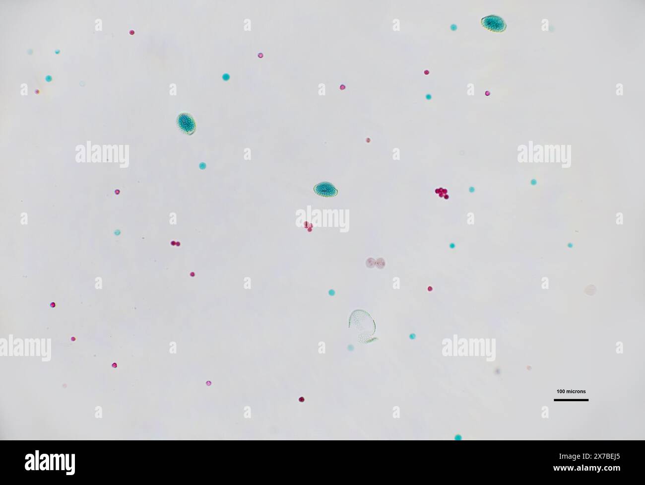pollen mélangé sous microscope à 10 fois grossissement Banque D'Images