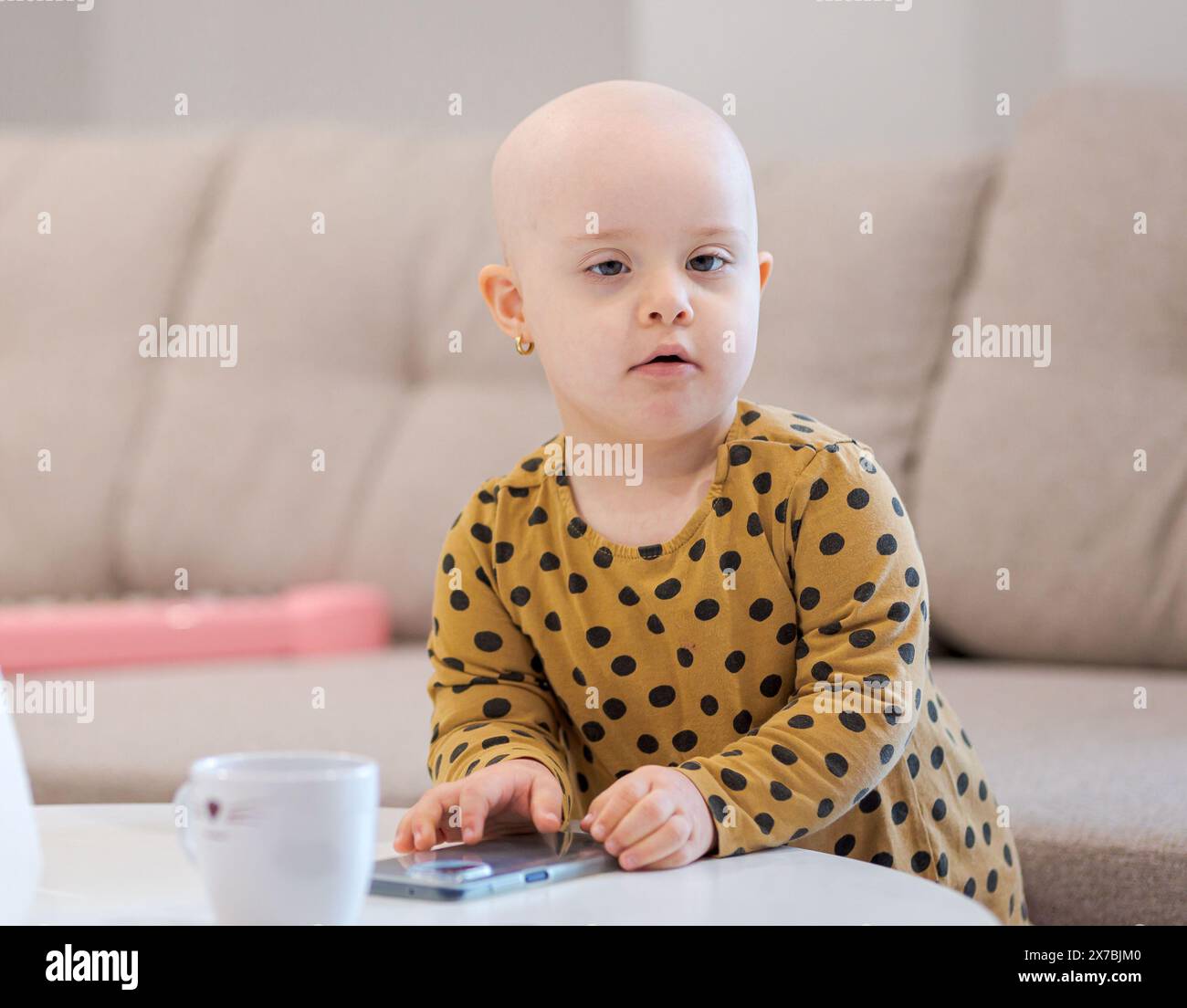 Bébé fille avec cancer et perte de cheveux due à la chimiothérapie jouant avec un smartphone Banque D'Images