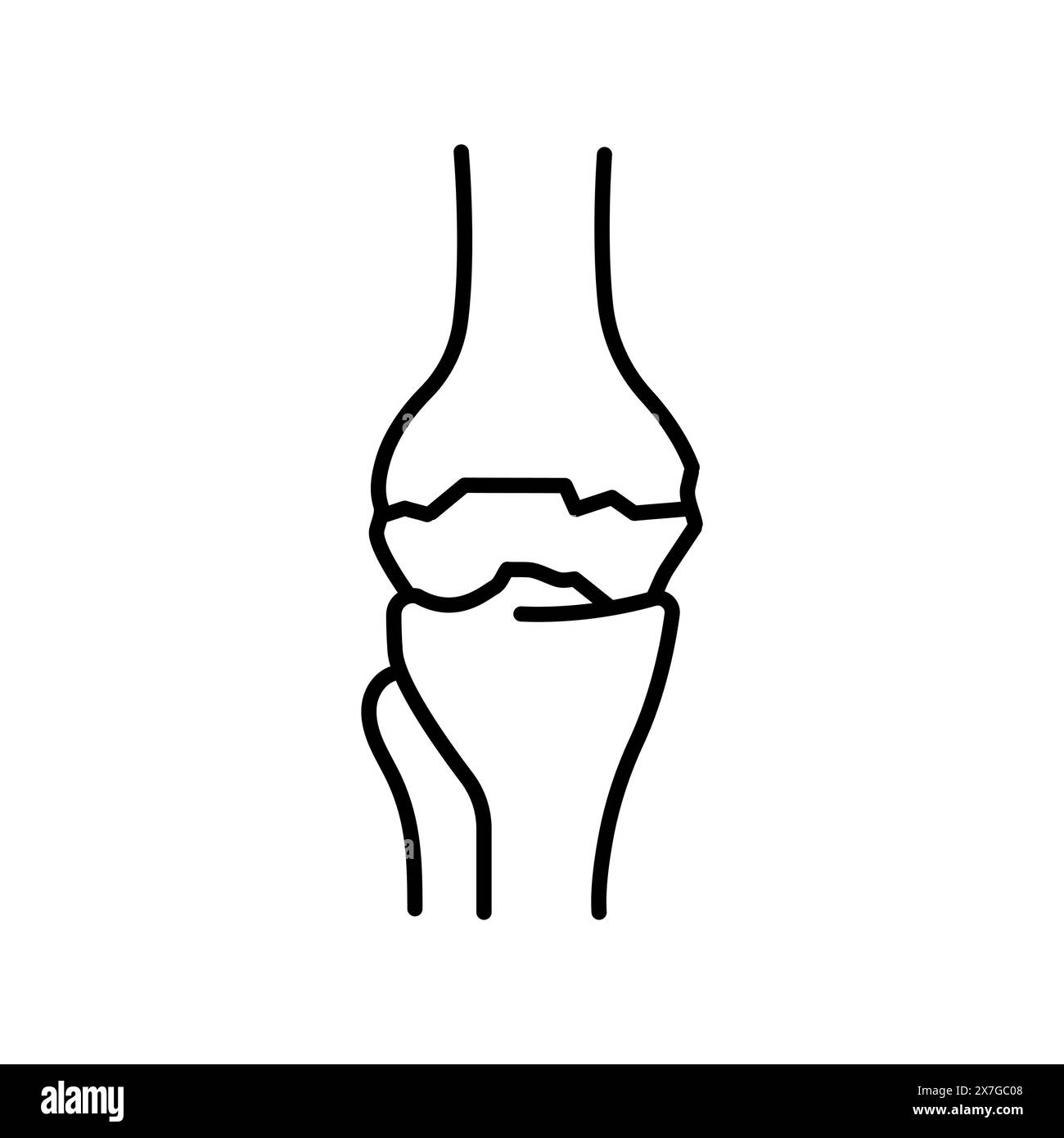 Icône noire de ligne d'arthrite. Signe de maladie humaine pour page web, application mobile, bouton, logo. Bouton isolé de vecteur. Contour modifiable. Illustration de Vecteur