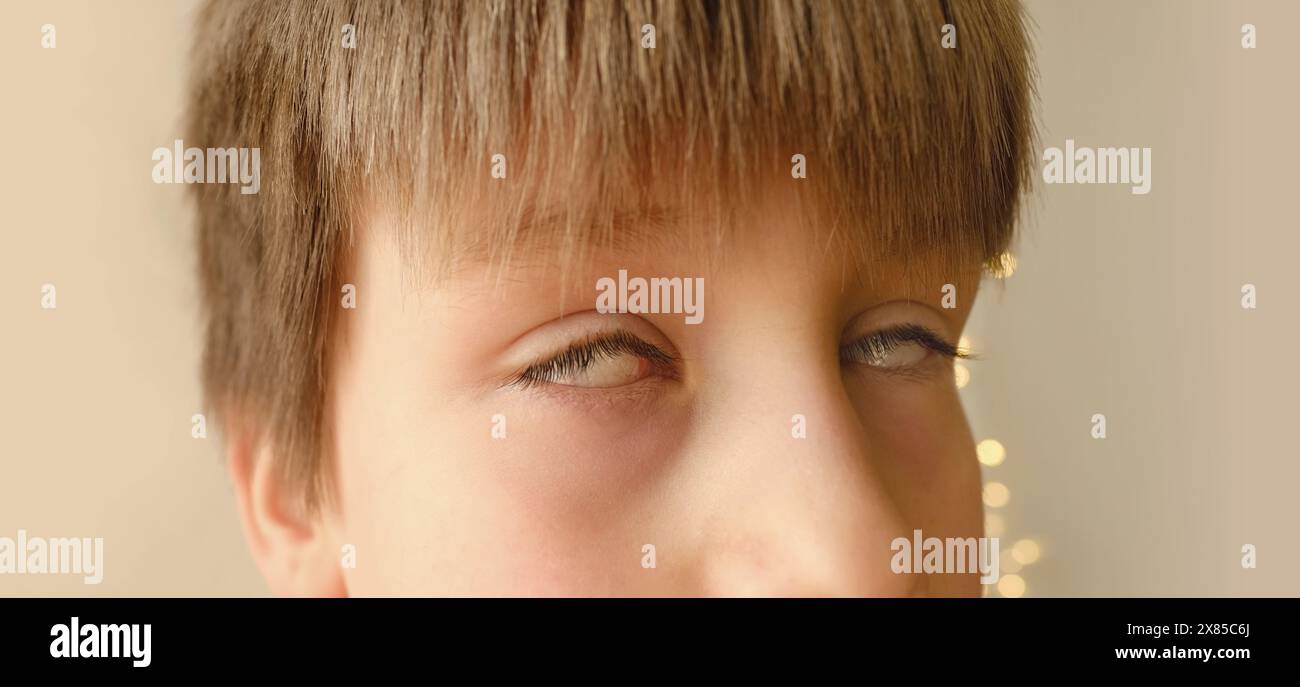 gros plan partie visage de l'enfant mâle, yeux bruns du garçon de 10-12 ans, yeux roulés, pas d'iris, photophobie, concept de santé oculaire, examen de la vue, soignants Banque D'Images