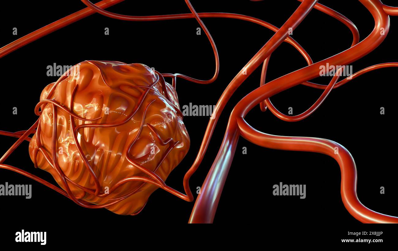 le rendu 3d du cancer nécessite un approvisionnement en sang pour fournir les nutriments et l'oxygène dont il a besoin pour croître et survivre Banque D'Images