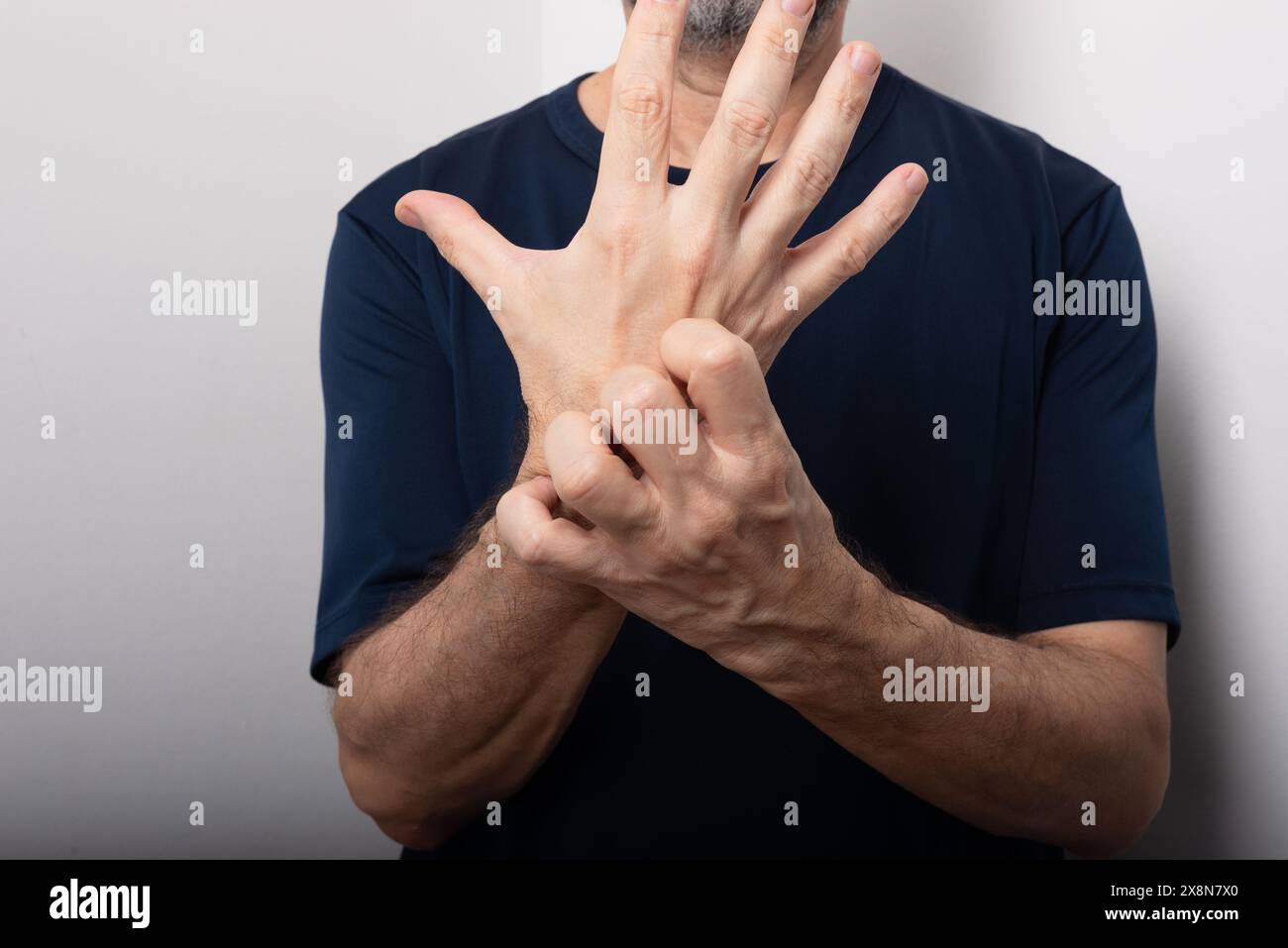 Homme d'âge moyen se grattant la main. Maladie de la peau. Réaction allergique. Soins dermatologiques Banque D'Images