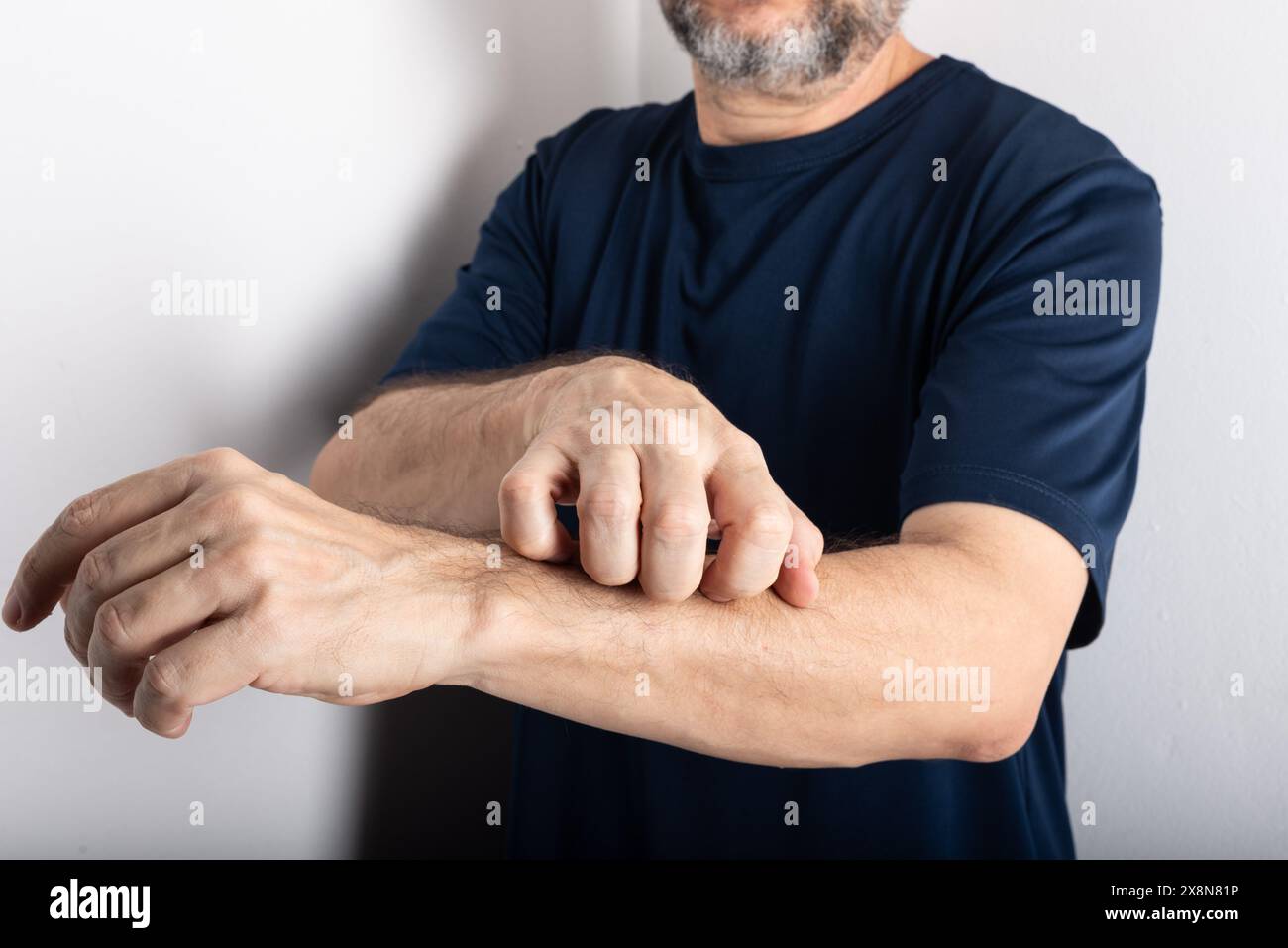 Homme d'âge moyen se grattant l'avant-bras. Maladie de la peau. Soins dermatologiques Banque D'Images