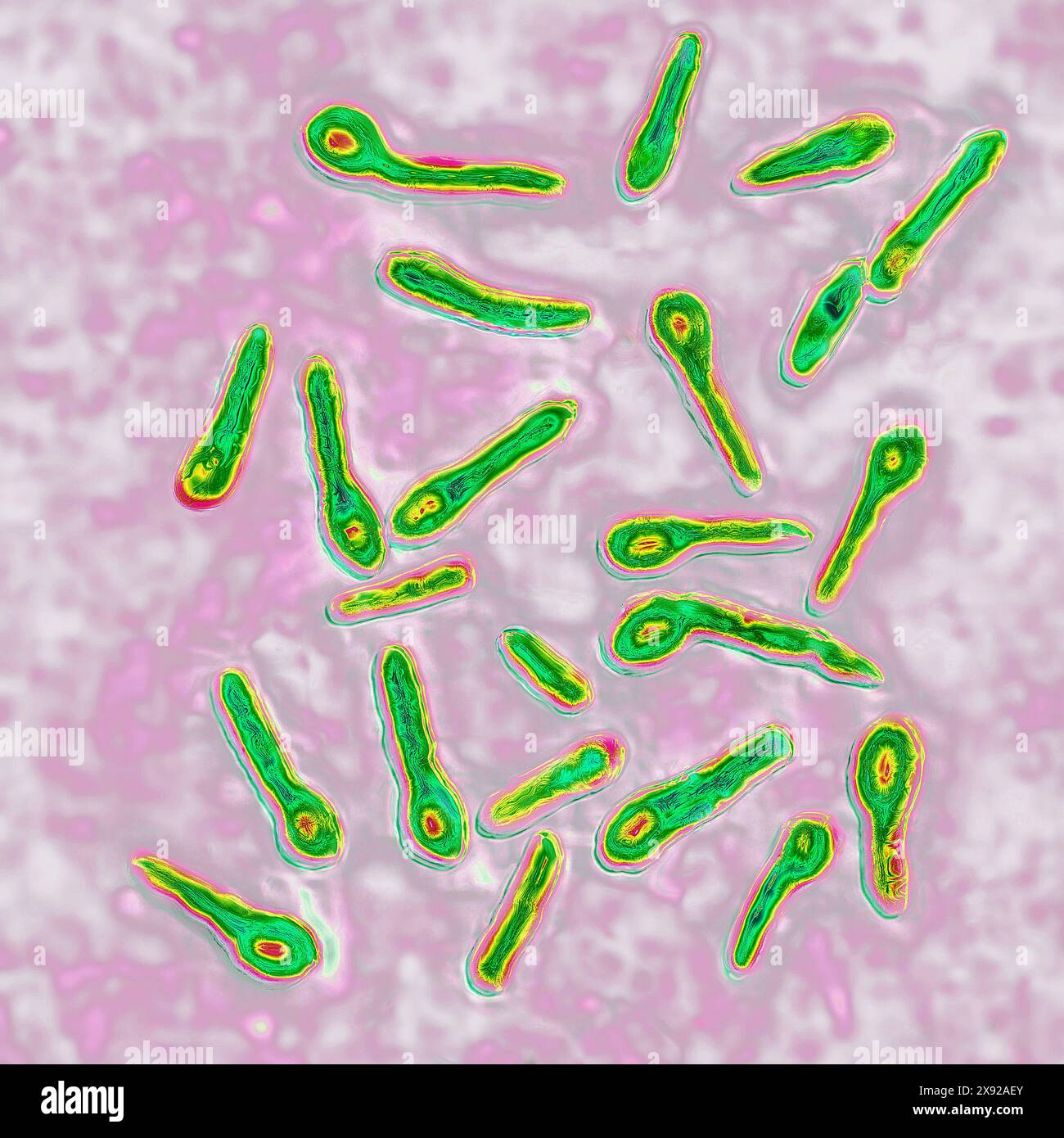 Clostridium tetani ou bacille de NicolaÃer est la bactérie responsable du tétanos. Même une contamination minimale dans une plaie conduit à la production d'une toxine neurotrope, la tétanospasmine, qui se lie au système nerveux central, causant des contractures et une paralysie. Image produite par microscopie optique. Bacille tétanique 016813 059 Banque D'Images