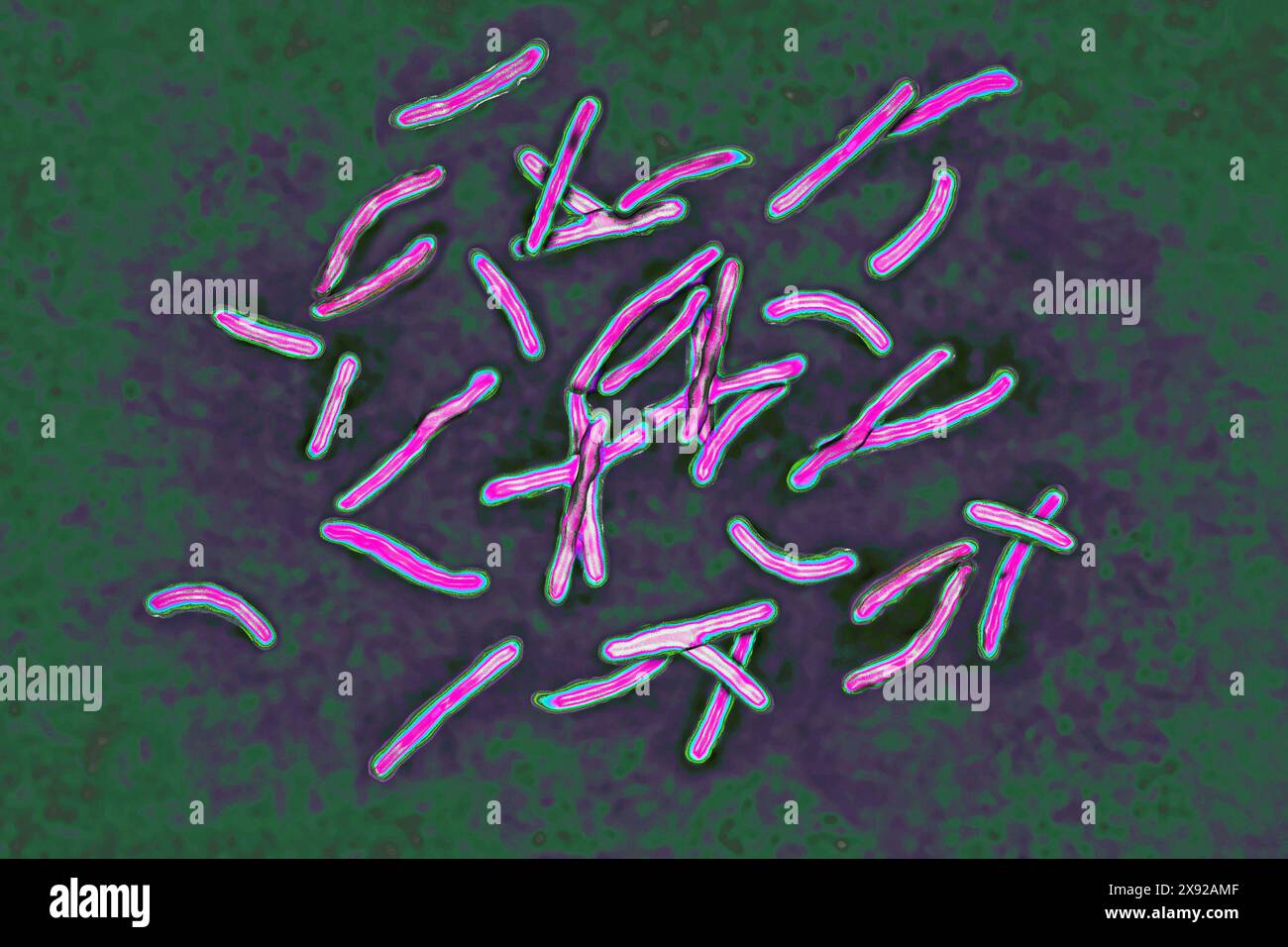 Bacillus Koch BK ou Mycobacterium tuberculosis, il est responsable de la tuberculose. La tuberculose fait son retour en raison de l'apparition de souches bactériennes multi-résistantes. La tuberculose pulmonaire phthisis est la plus répandue, mais il existe des troubles osseux maladie de Pott, tumeur blanche du genou, troubles rénaux, intestinaux, génitaux, méningés et cutanés tuberculomes. Image tirée d'une microscopie optique X 1000. Bacille de Koch 016813 007 Banque D'Images