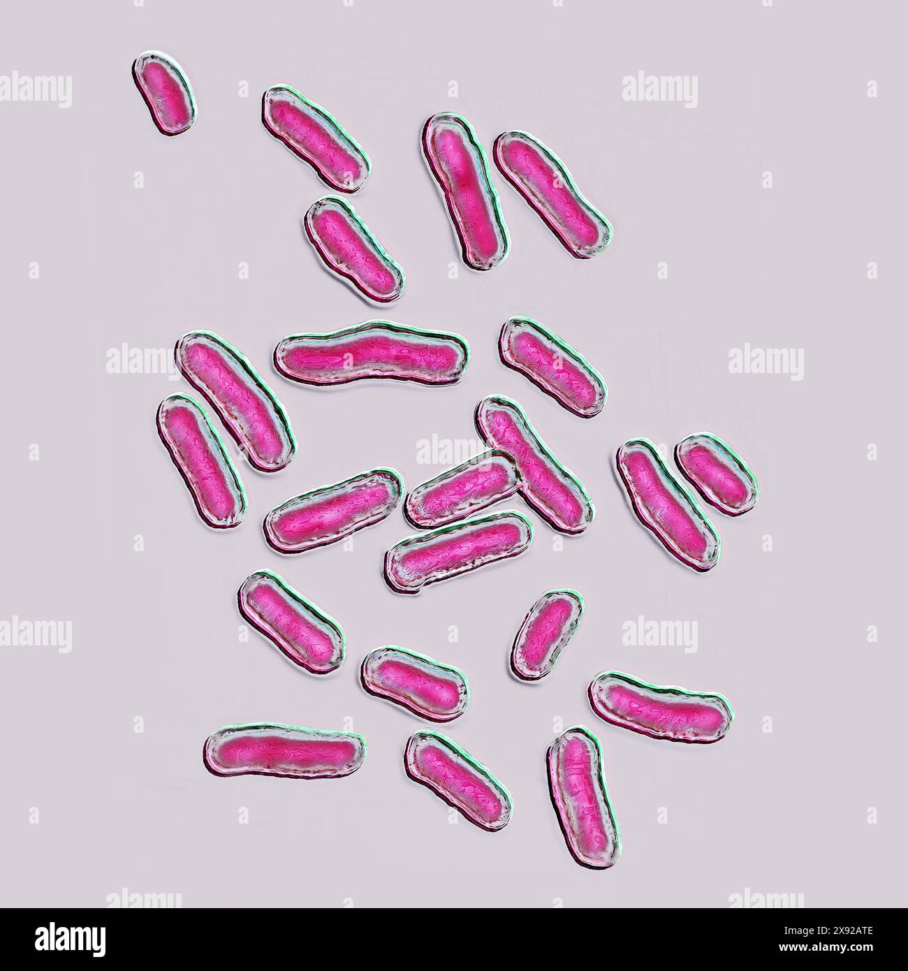 Salmonella est la bactérie responsable de la salmonellose, une maladie d'origine alimentaire très répandue. La salmonellose se caractérise généralement par une poussée aiguë de fièvre, des douleurs abdominales, de la diarrhée, des nausées, une déshydratation sévère, septicémies. Image produite par microscopie optique. Bactéries Salmonella 016813_041 Banque D'Images