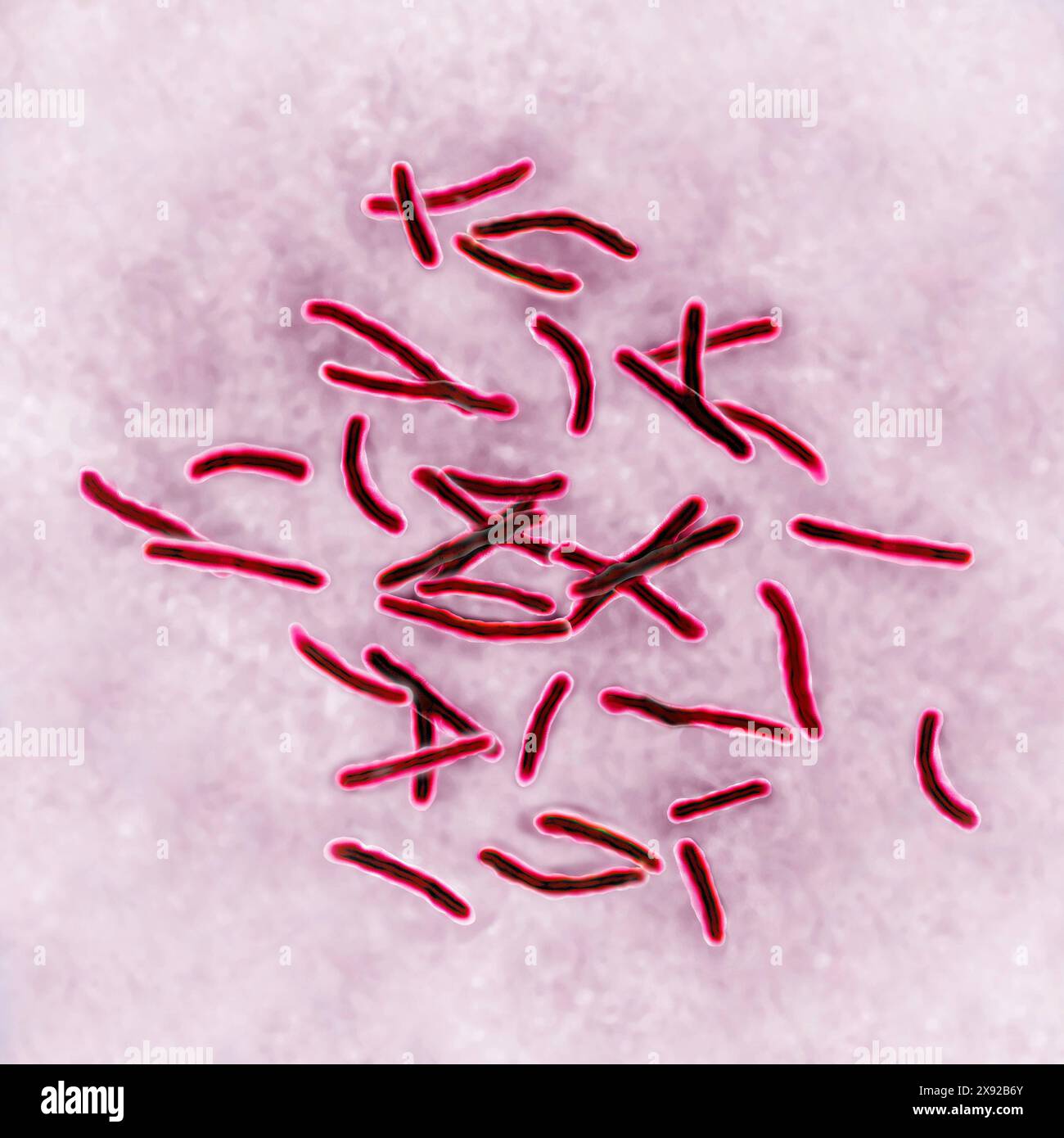 Bacillus Koch BK ou Mycobacterium tuberculosis, il est responsable de la tuberculose. La tuberculose fait son retour en raison de l'apparition de souches bactériennes multi-résistantes. La tuberculose pulmonaire phthisis est la plus répandue, mais il existe des troubles osseux maladie de Pott, tumeur blanche du genou, troubles rénaux, intestinaux, génitaux, méningés et cutanés tuberculomes. Image tirée d'une microscopie optique X 1000. Bacille de Koch 016813 009 Banque D'Images