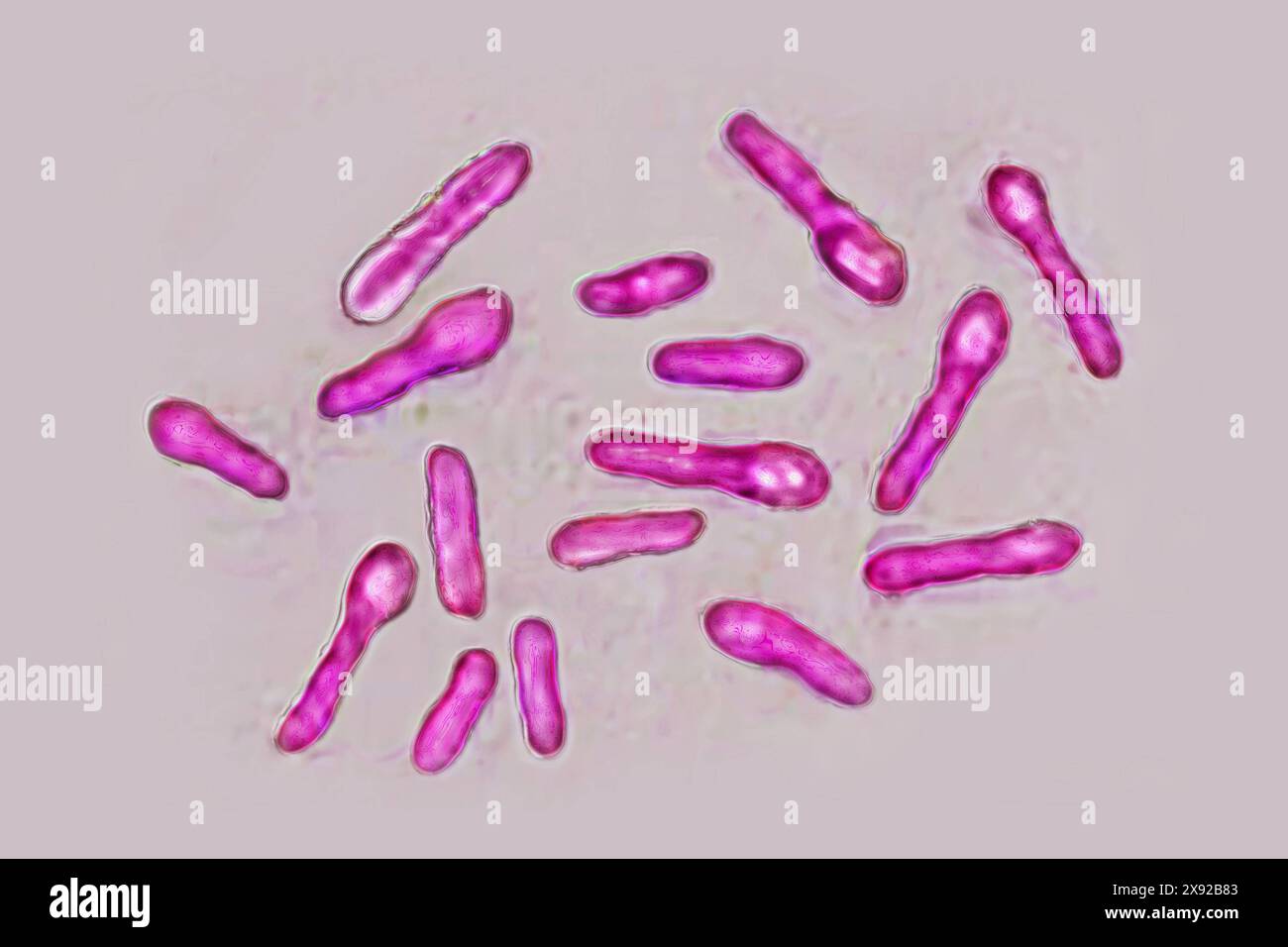 Bacille botulique à Clostridium botulinum. Cette bactérie sécrète une toxine très puissante, le botox, qui inhibe les motoneurones de la contraction musculaire. Image tirée d'une microscopie optique X 1000. Bactéries Clostridium botulinum 016813 001 Banque D'Images