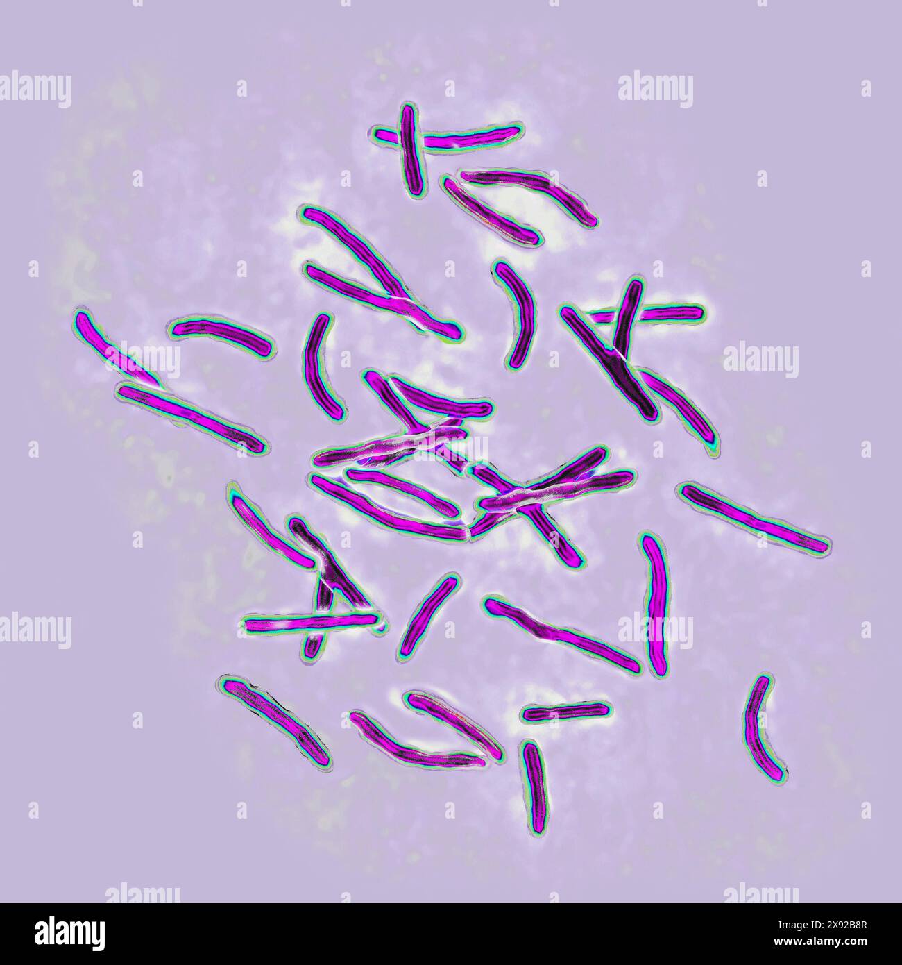 Bacillus Koch BK ou Mycobacterium tuberculosis, il est responsable de la tuberculose. La tuberculose fait son retour en raison de l'apparition de souches bactériennes multi-résistantes. La tuberculose pulmonaire phthisis est la plus répandue, mais il existe des troubles osseux maladie de Pott, tumeur blanche du genou, troubles rénaux, intestinaux, génitaux, méningés et cutanés tuberculomes. Image tirée d'une microscopie optique X 1000. Bacille de Koch 016813 008 Banque D'Images