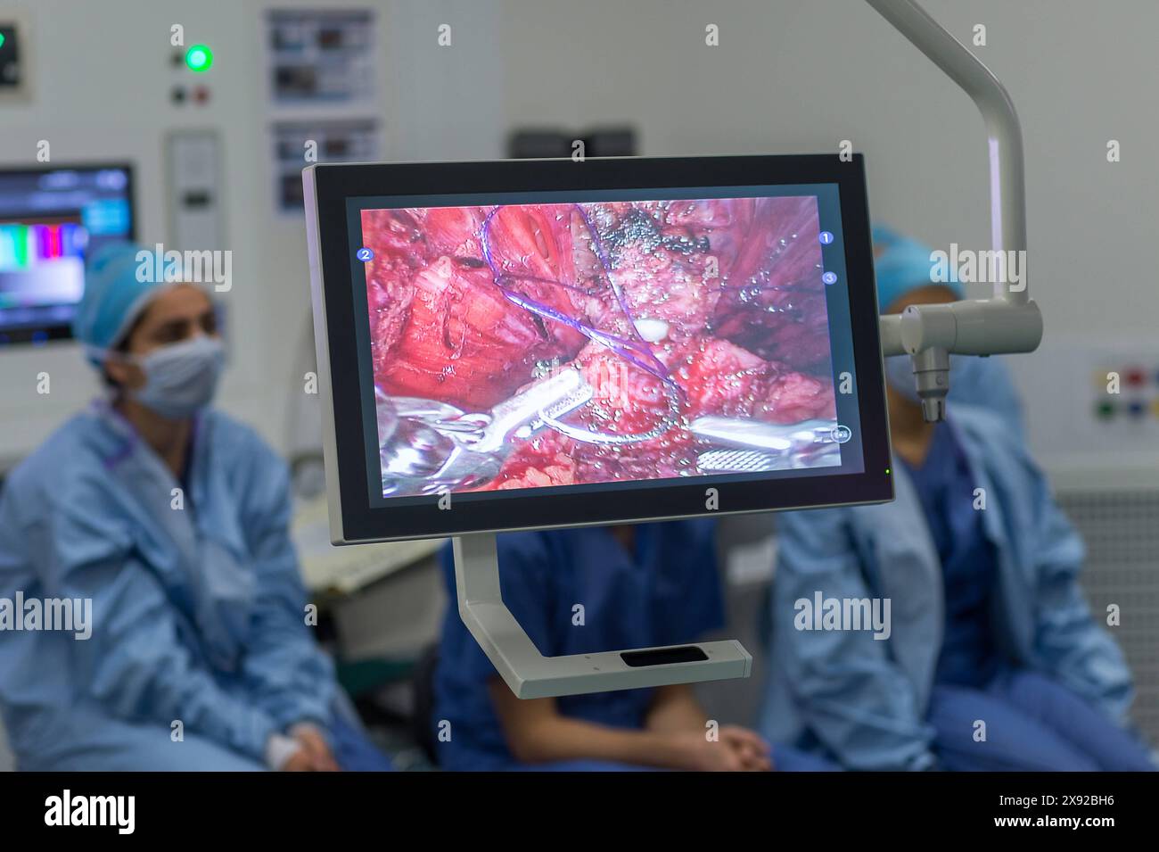 Bilan au CHU de Nice, CHU Pasteur, d'une prostatectomie radicale avec dissection ganglionnaire chez un patient de 66 ans atteint de cancer de la prostate à haut risque selon la classification d Amico. Prostatectomie laparoscopique assistée par le robot da vinci 015809 096 Banque D'Images