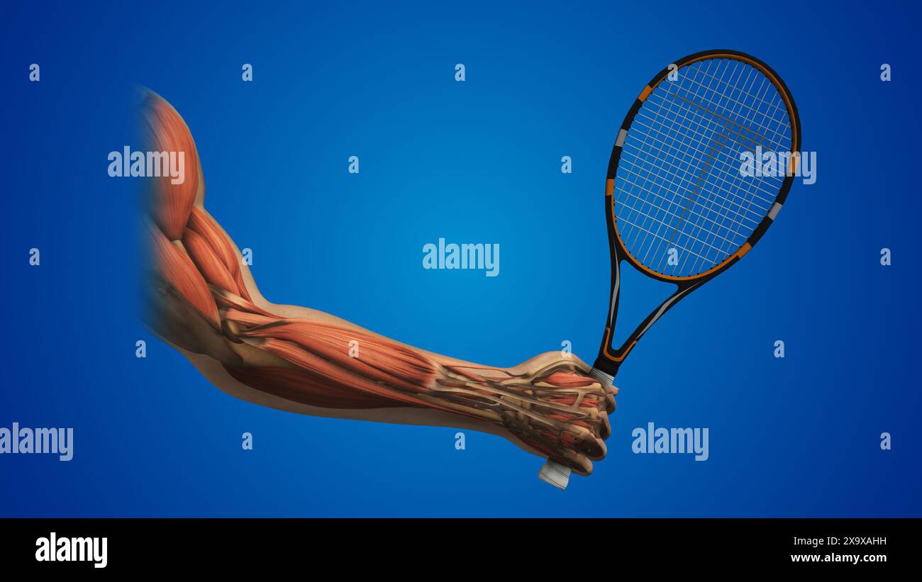 Tennis elbow zone de douleur inflammation Banque D'Images