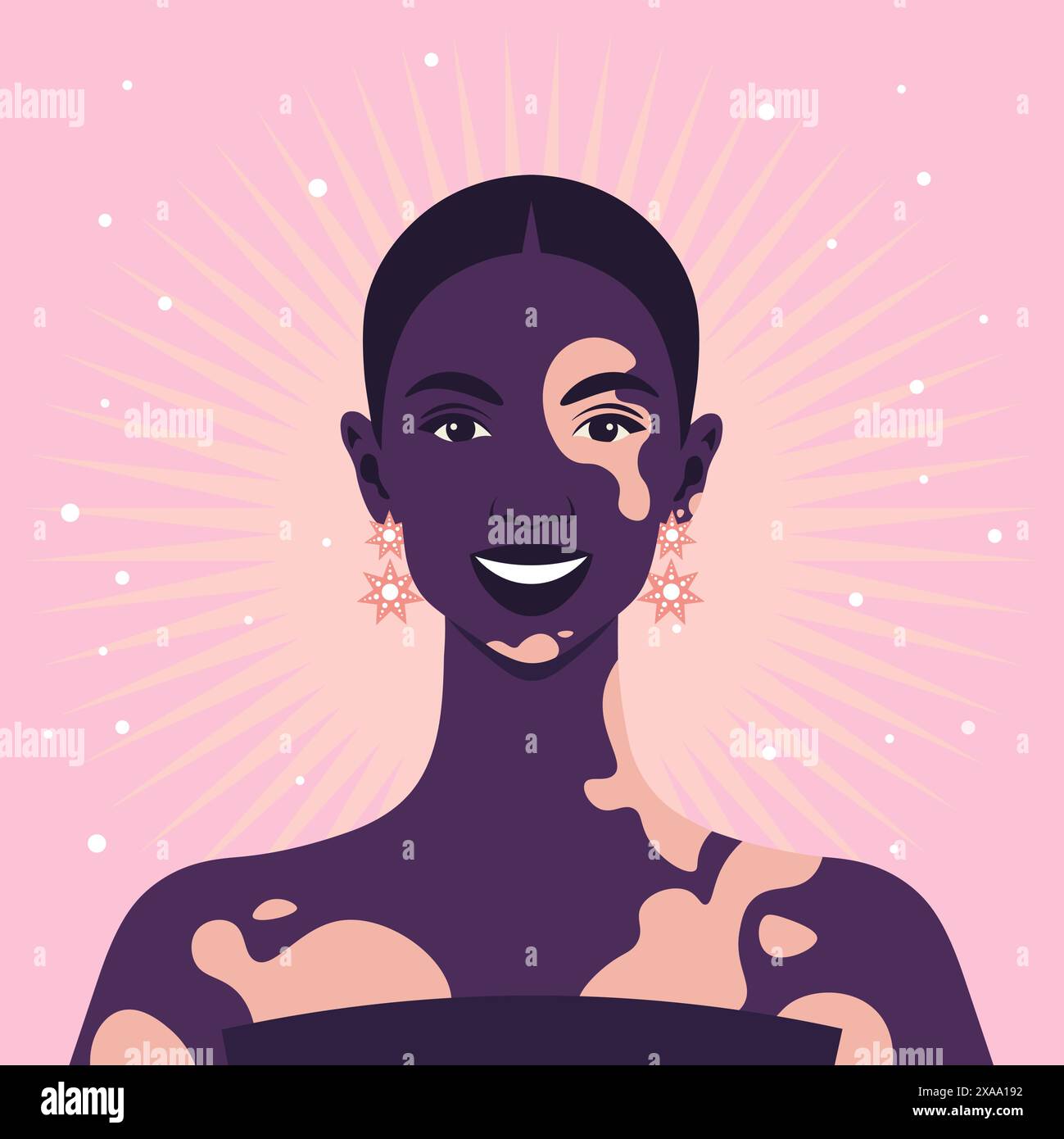 Le visage d'une femme africaine heureuse avec dépigmentation vitiligo sur fond rose. Illustration vectorielle plate Illustration de Vecteur