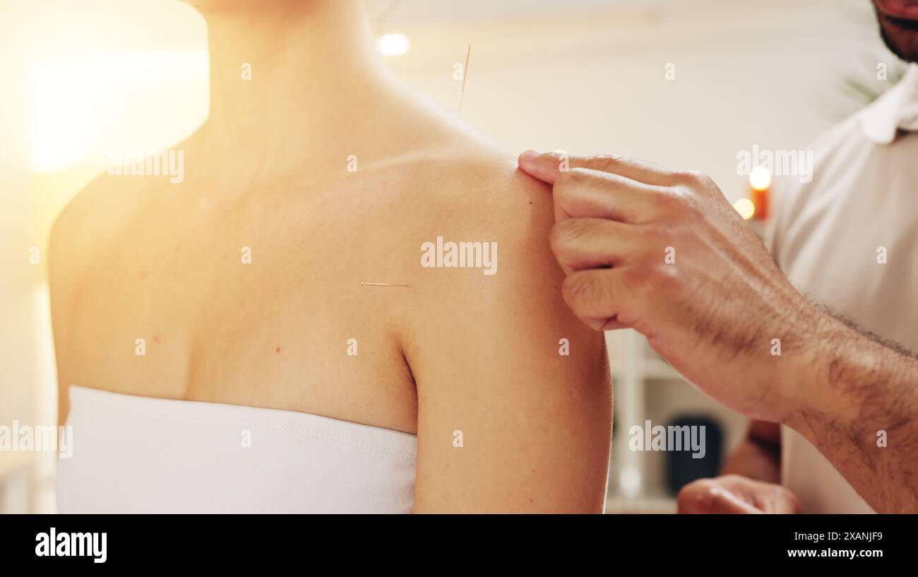 Acupuncture, mains et épaules dans le spa avec traitement client pour la guérison, le soulagement du stress ou la thérapie. Corps, holistique et détente avec masseuse en station Banque D'Images