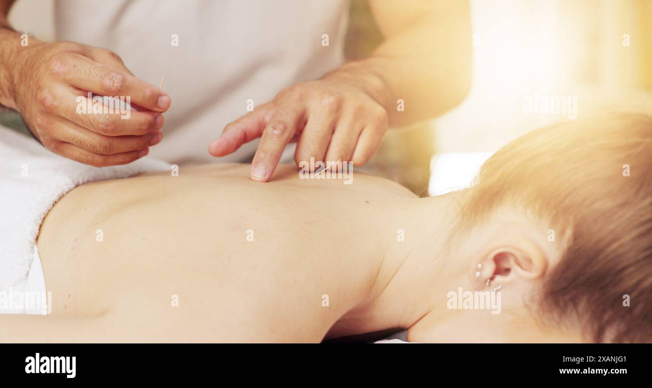 Acupuncture, dos et mains en spa avec traitement client pour la guérison, le soulagement du stress ou la thérapie. Corps, aiguilletage sec et holistique avec masseuse dans Banque D'Images