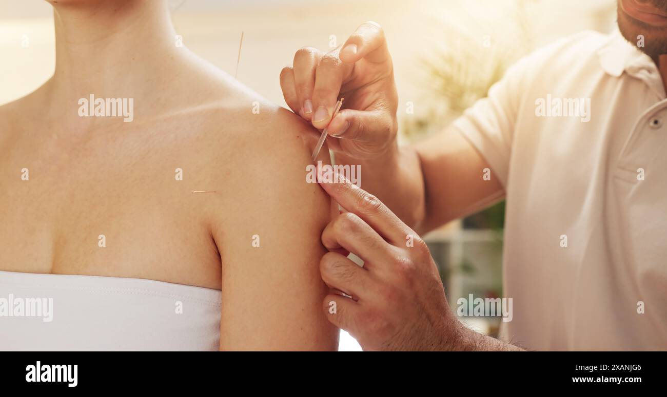 Acupuncture, holistique et épaule en spa avec traitement client pour la guérison, le soulagement du stress ou la thérapie. Corps, mains et détente avec masseuse en station Banque D'Images