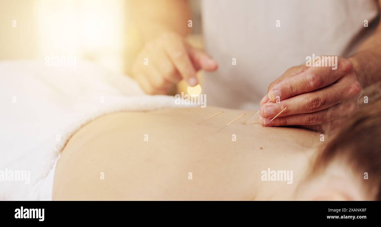 Acupuncture, mains et soulagement du stress en spa avec client pour la guérison, la thérapie holistique ou pour se détendre. Corps, aiguilletage sec et traitement avec masseuse in Banque D'Images