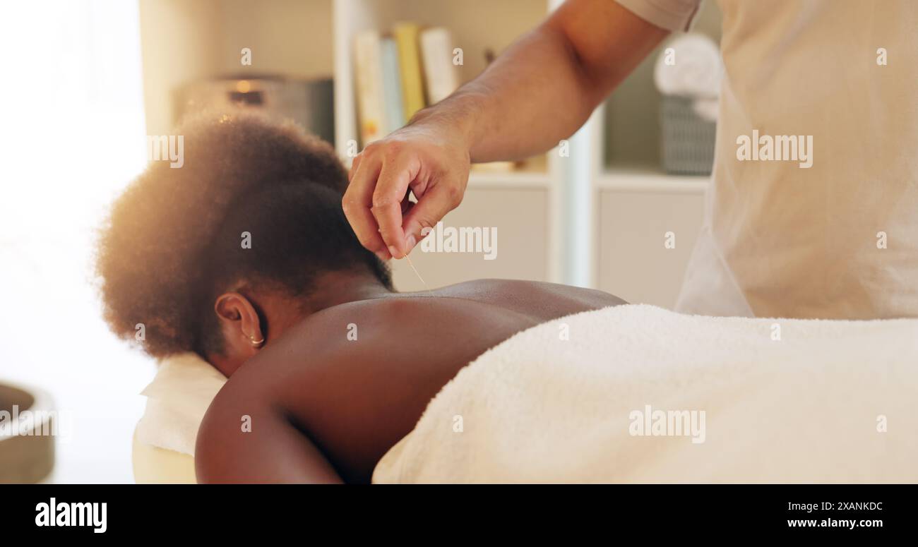 Acupuncture, dos et soins de la peau en spa avec traitement client pour la guérison, le soulagement du stress ou la thérapie. Corps, aiguilletage sec et main de masseuse avec Banque D'Images