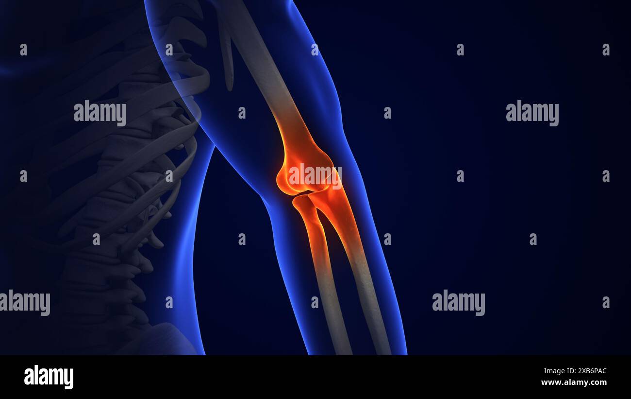 Anatomie traitement de l'articulation du coude humain Banque D'Images