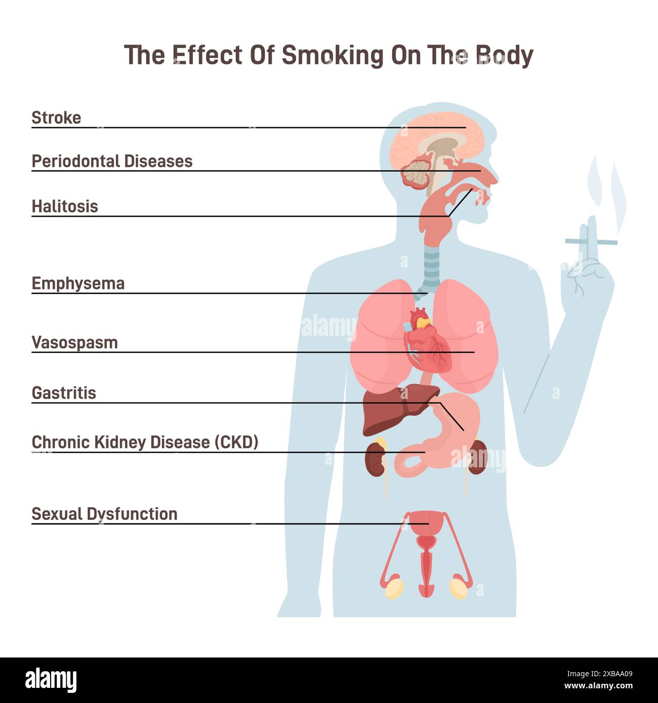 Effets du tabagisme sur le corps humain. Problèmes de santé et risques des fumeurs. Affections des organes internes humains dues à la nicotine. Illustration vectorielle plate Illustration de Vecteur