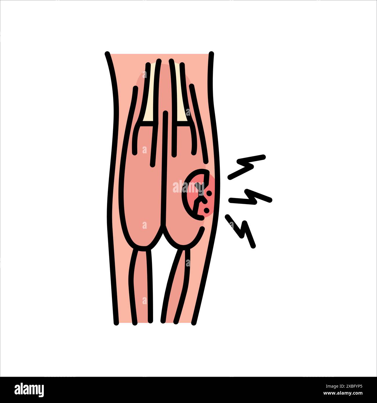 Icône de couleur de ligne de déformation. Signe de blessures domestiques pour la page Web, l'application mobile, le bouton, le logo. Bouton isolé de vecteur. Contour modifiable. Illustration de Vecteur