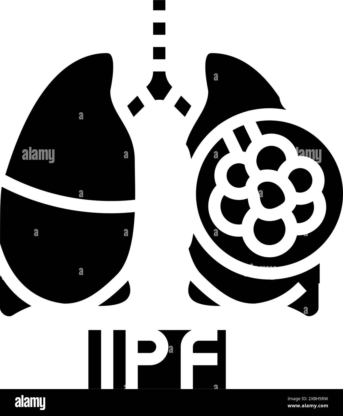illustration vectorielle d'icône de glyphe de fibrose pulmonaire idiopathique Illustration de Vecteur