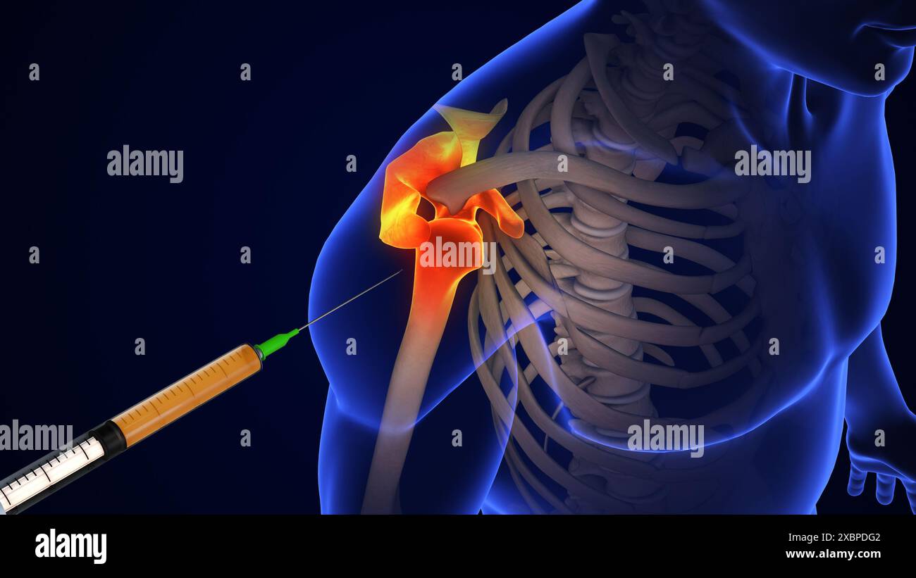 Anatomie traitement de l'articulation de l'épaule humaine Banque D'Images