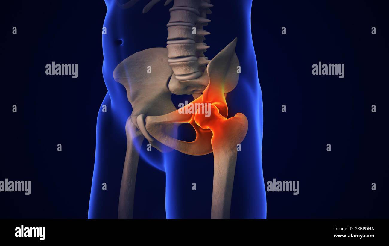 Anatomie traitement de l'articulation de la hanche humaine Banque D'Images