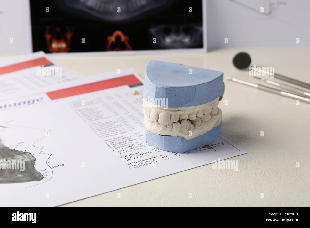 Modèle dentaire avec gencives, cartes anatomiques et radiographie panoramique sur table. Fonte de dents Banque D'Images