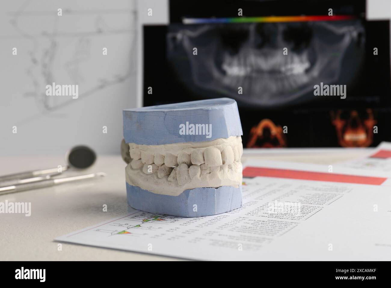 Modèle dentaire avec gencives, cartes anatomiques et radiographie panoramique sur table. Fonte de dents Banque D'Images