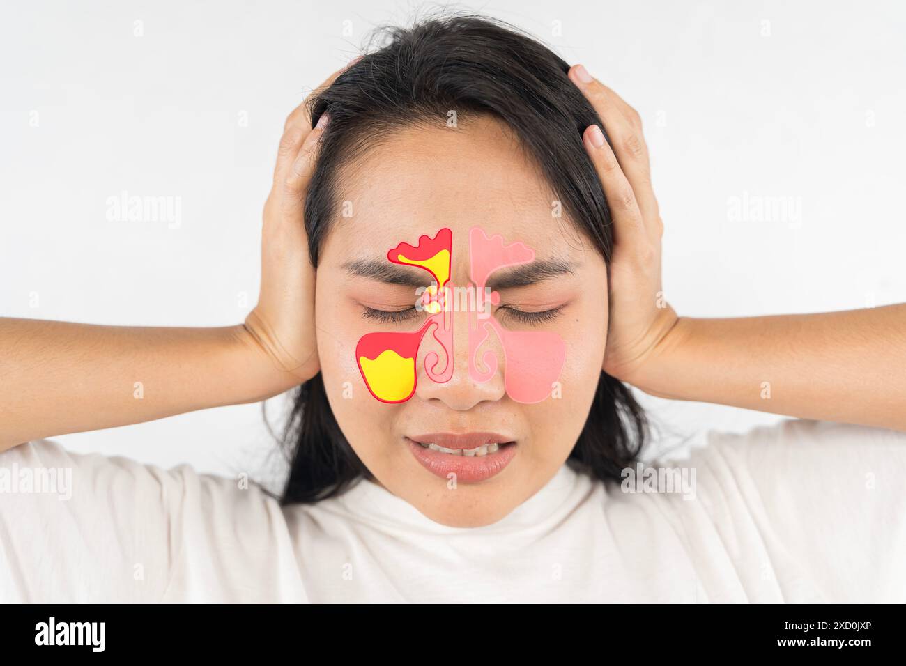 Sinusite, frontite. Face féminine avec inflammation de la muqueuse des sinus paranasaux et frontaux. Une femme au nez rouge et aux yeux rouges. Elle l'est Banque D'Images