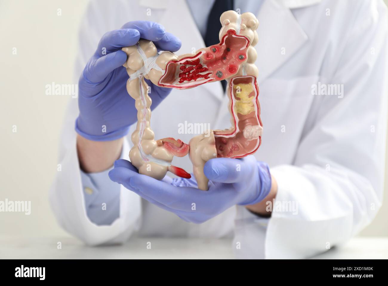 Médecin avec modèle de gros intestin, foyer sélectif Banque D'Images