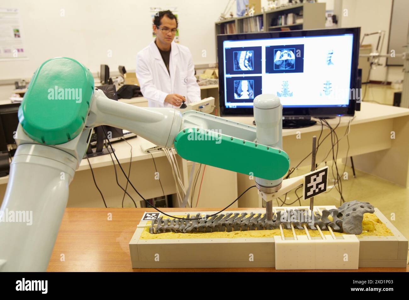 Le système robotique pour assister la chirurgie est la cible de fixation transpediculaire, système de placement de vis, composé de 3 modules fonctionnels : preoperativ Banque D'Images