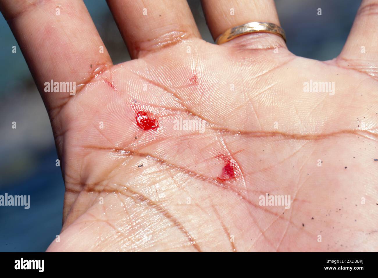 Plaie hémorragique sur la main d'un homme suite à un accident. Macro de coupures sur la peau humaine avec perte de sang. Concept d'accidents du travail. Banque D'Images