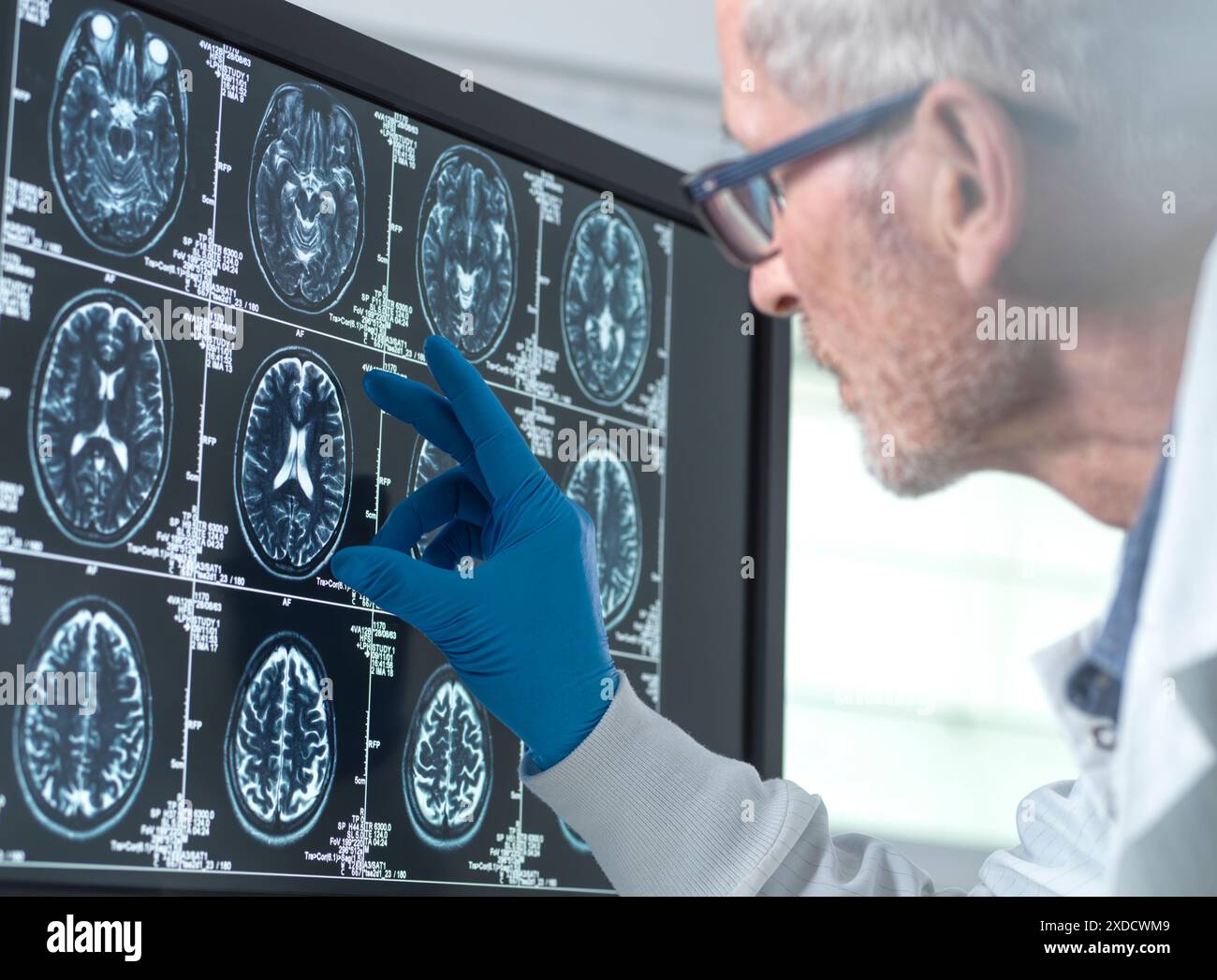 Scientifique examinant l'IRM du cerveau d'un patient pour déceler le vieillissement et les dommages dus à la démence et à la maladie d'Alzheimer. Banque D'Images