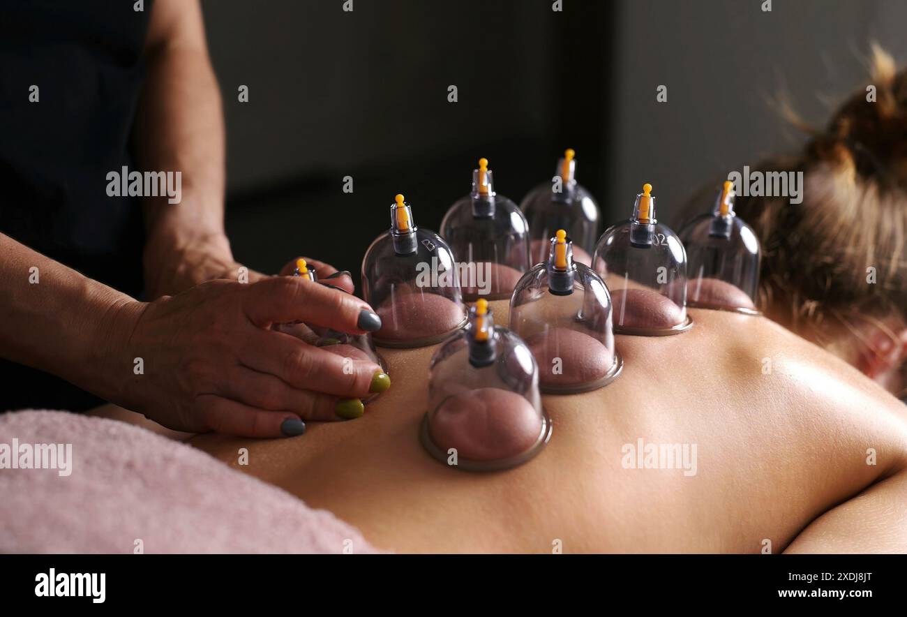 Massage Cupping sous vide pour la ligne jeune femme sur Une table de massage Banque D'Images