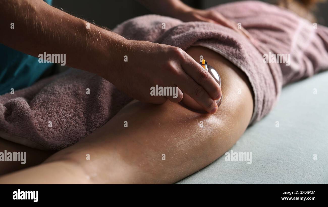 Procédures avec Une tasse à vide pour la ligne jeune femme sur Une table de massage pour se débarrasser de l'excès de graisse sur les fesses Banque D'Images