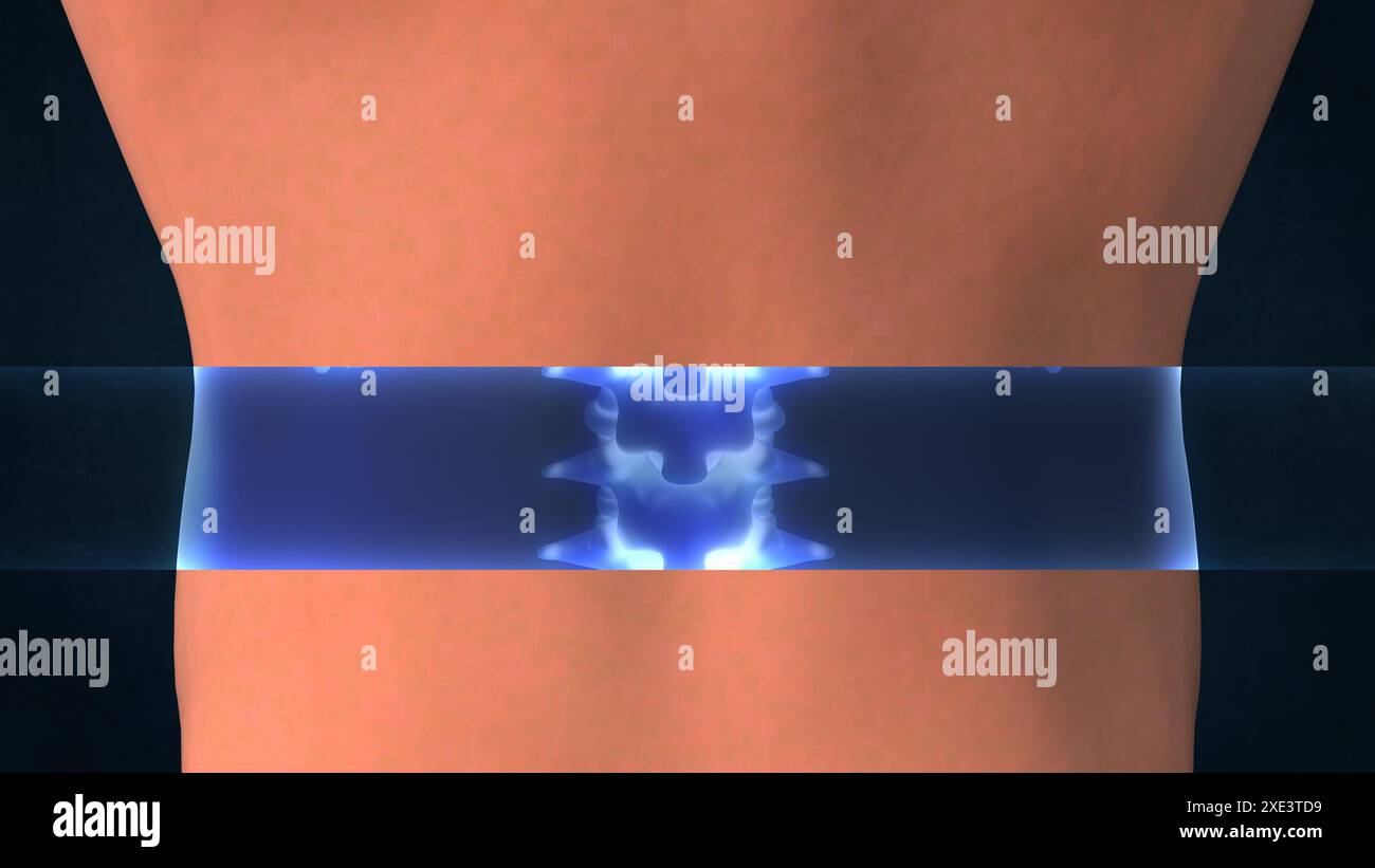 Une radiographie d'une colonne vertébrale humaine Banque D'Images