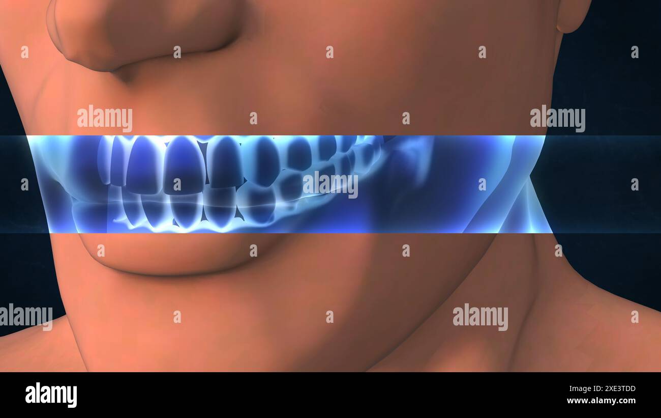 Une radiographie d'une dent humaine Banque D'Images