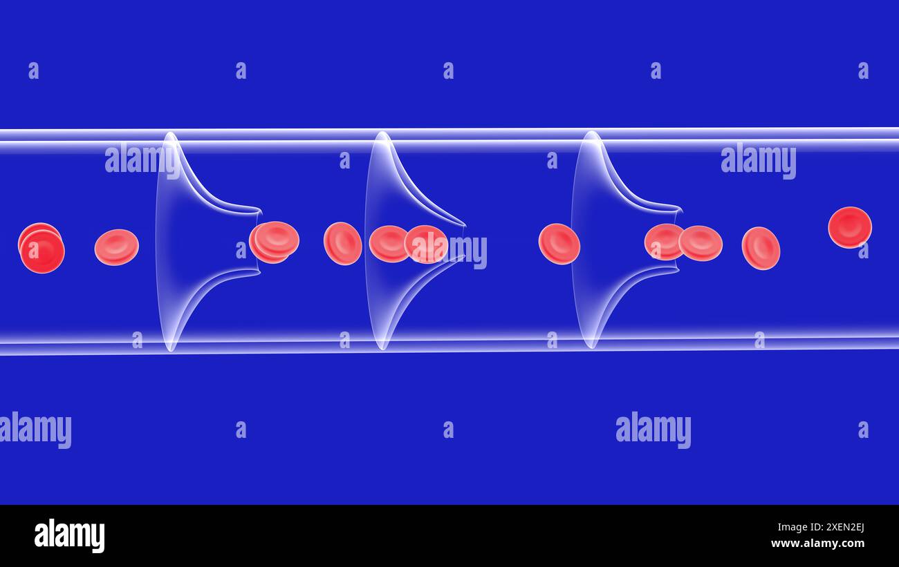 Le Point Rp6 Contre Une Mauvaise Circulation Du Sang Mauvaise circulation sanguine Banque de photographies et d’images à