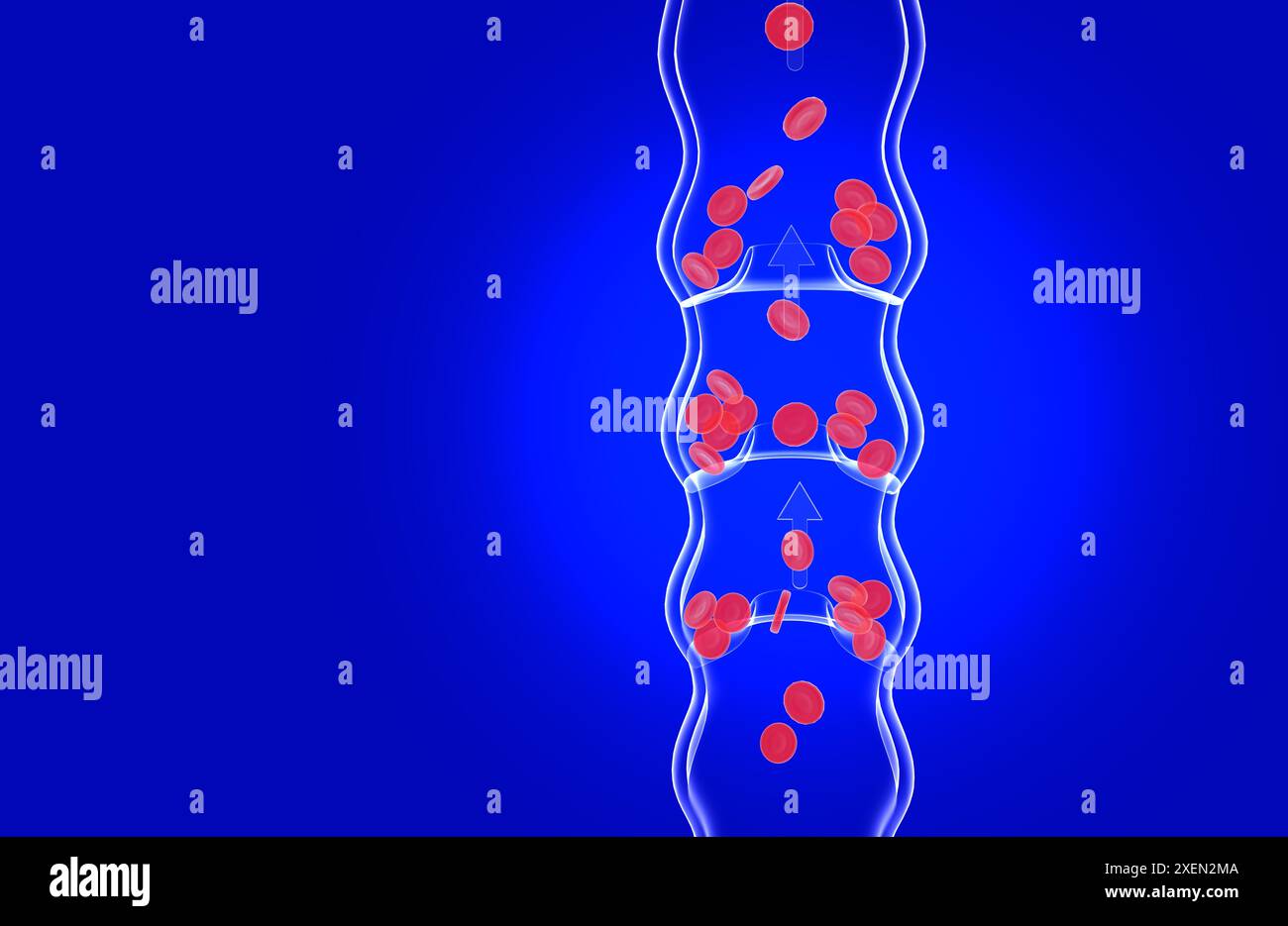 Animation anatomique tridimensionnelle d'une veine verticale malade et incompétente. Dysfonctionnement des valves accumulant les globules rouges. Image transparente de verre. Banque D'Images
