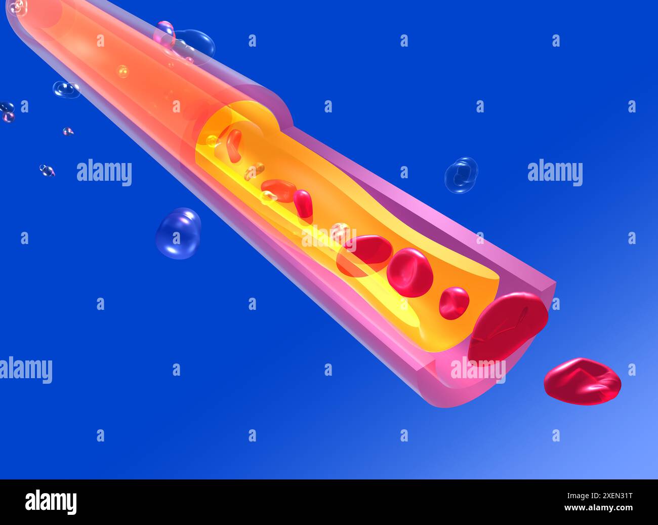 Illustration anatomique 3D d'une artère avec obstruction due à la graisse collée aux parois qui augmente. Mouvement des globules rouges et des plaquettes. Banque D'Images