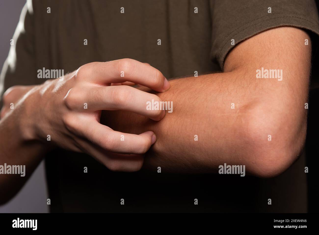 Jeune homme se grattant le bras avec sa main. Maladie de la peau. Irritation, allergie. Isolé sur fond noir. Banque D'Images Jeune homme se grattant le bras avec sa main. Maladie de la peau. Irritation, allergie. Isolé sur fond noir. Banque D'Images