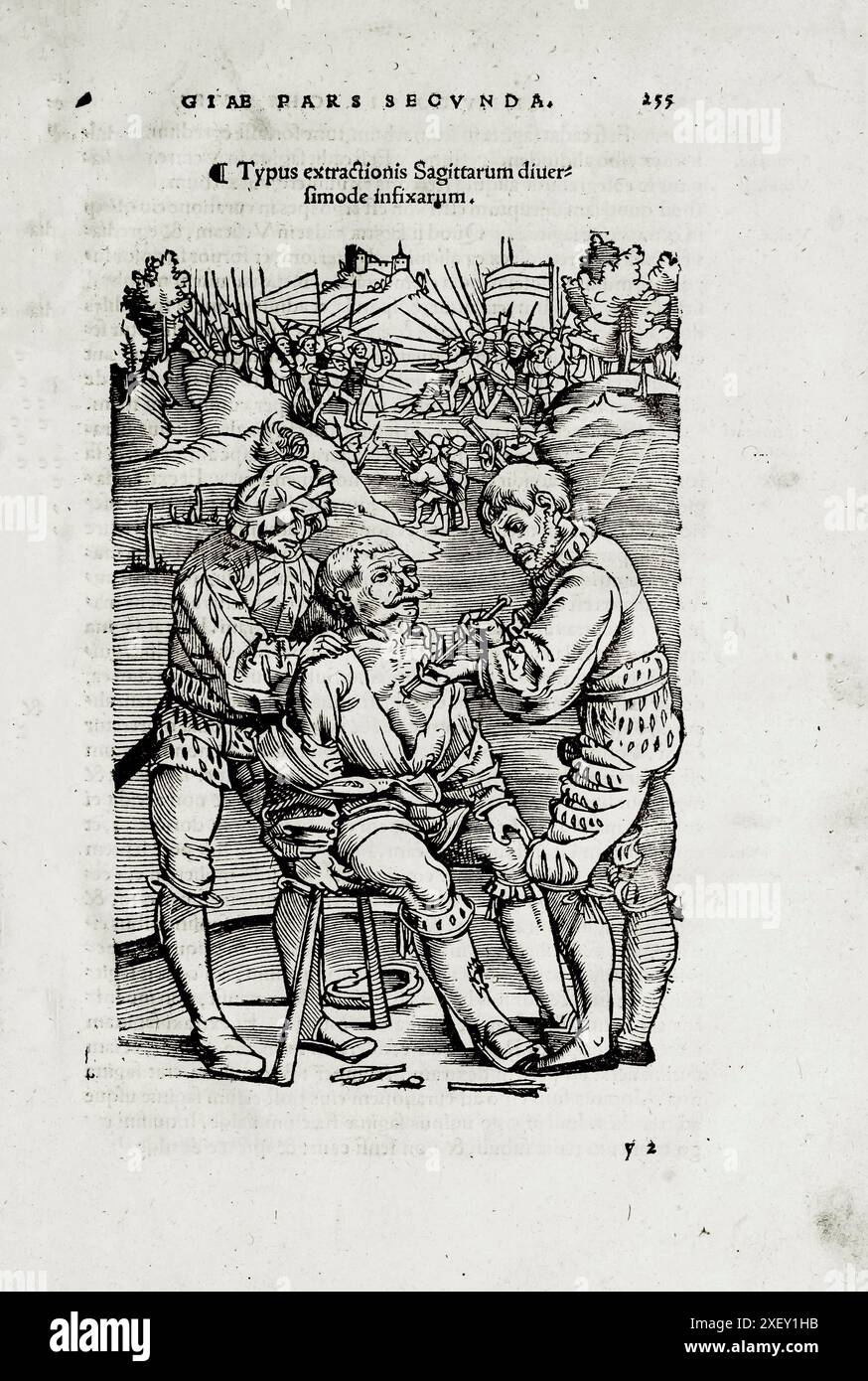 Illustration du XVIe siècle de la chirurgie et des interventions chirurgicales au moyen âge : ablation chirurgicale d'une arbalète sur le champ de bataille. D'après les livres médiévaux d'Octavius Horatianus et Abu al-Qasim Khalaf ibn al-Abbas al-Zahrawi. 1532 Banque D'Images