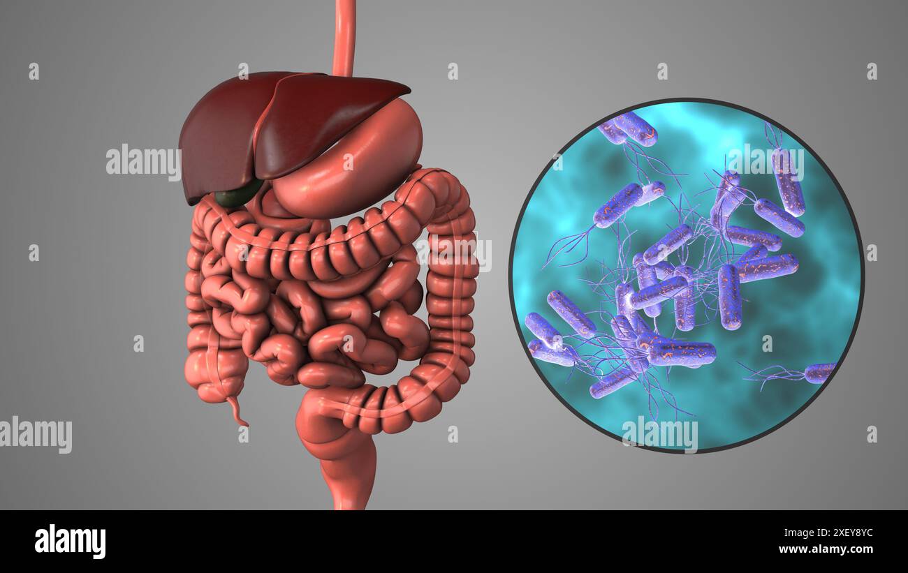 Infection gastrique à Helicobacter pylori Banque D'Images