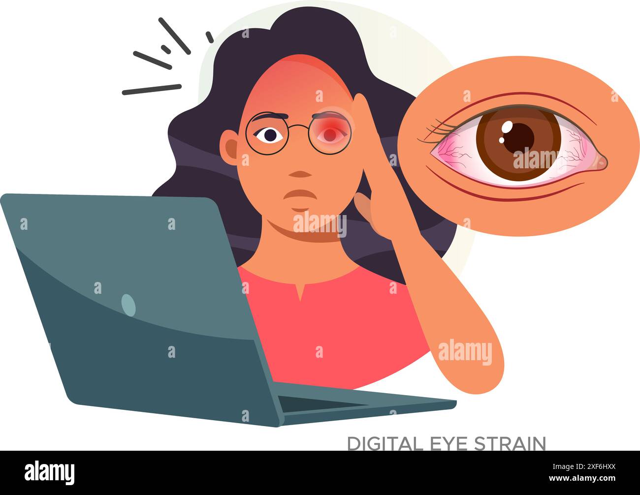 Digital Eye Strain, personne assise sur la table de travail avec fatigue oculaire - illustration stock comme fichier EPS 10 Illustration de Vecteur