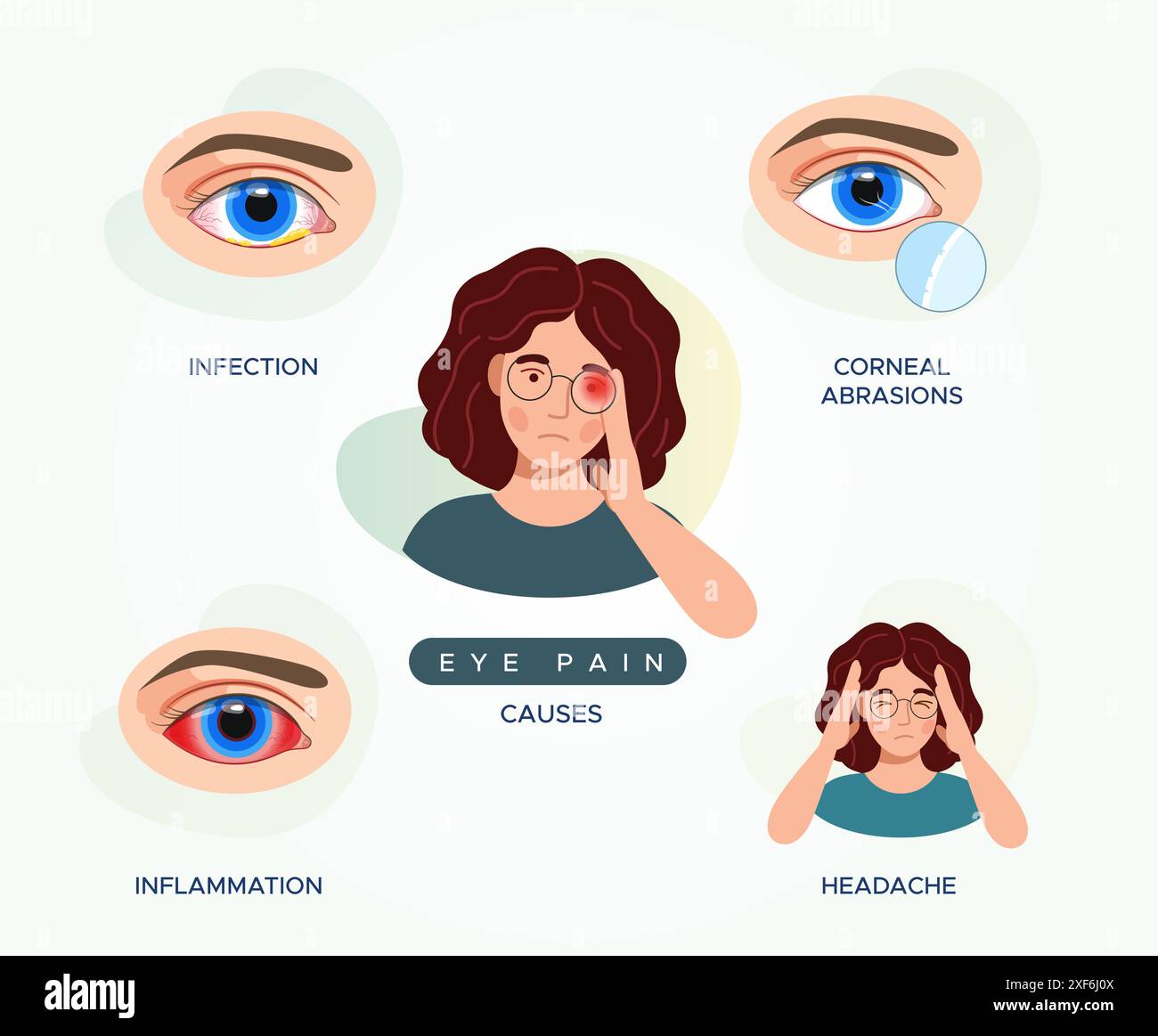 Déformation oculaire et douleur - causes - illustration stock en tant que fichier EPS 10 Illustration de Vecteur