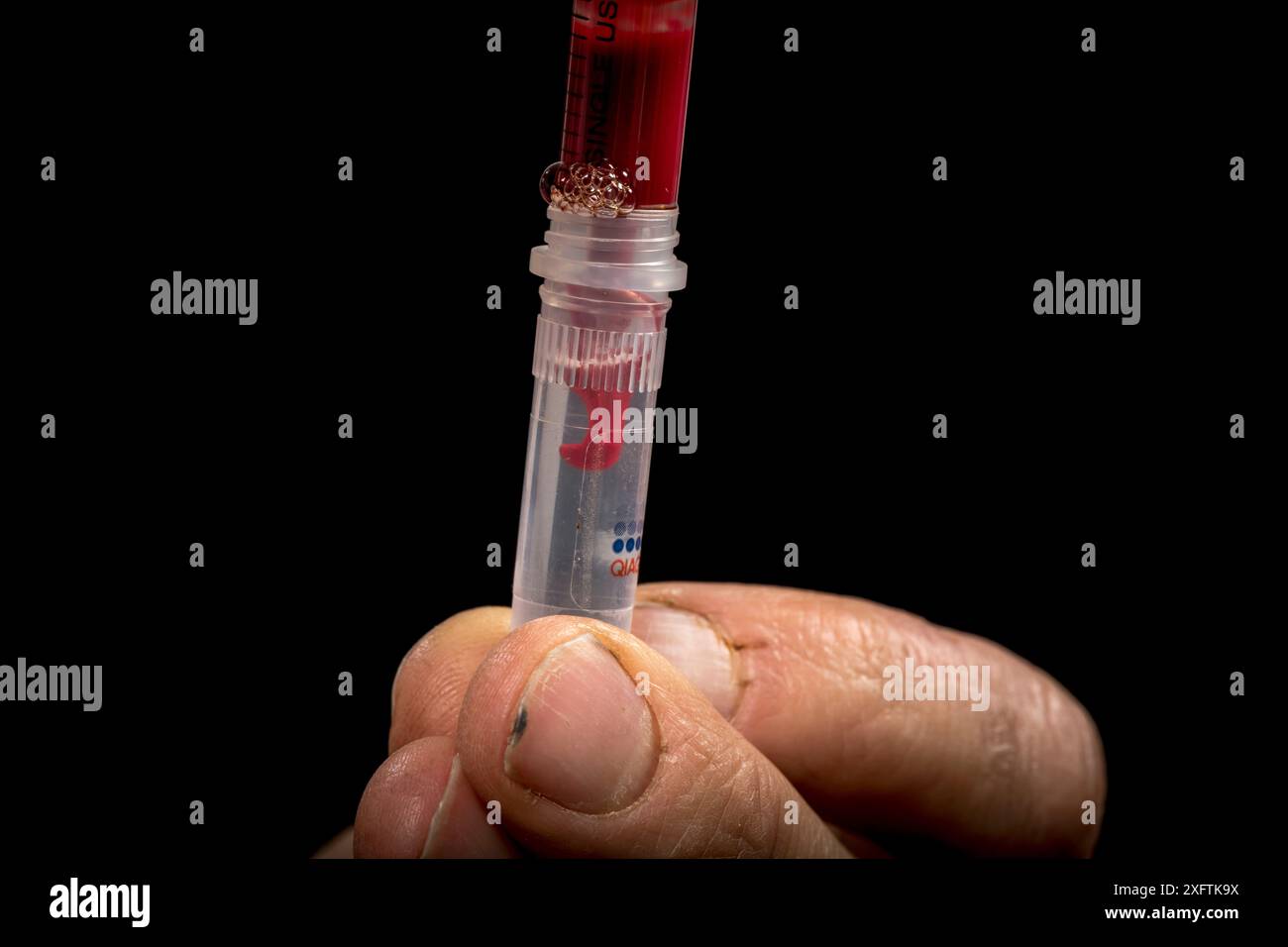 Ornithorhynchus anatinus sang prélevé sur un ornithorhynchus anesthésié capturé en champ. Il sera placé dans un tube à essai pour une analyse ultérieure. Dartmouth, Victoria, Australie. Mai 2018. Banque D'Images