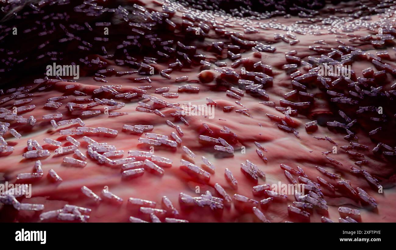 Concept des poumons infectés par la main du médecin, présence d'infection à mycobactéries tuberculeuses, tuberculose bactérienne, cancer du poumon et maladie pulmonaire Banque D'Images